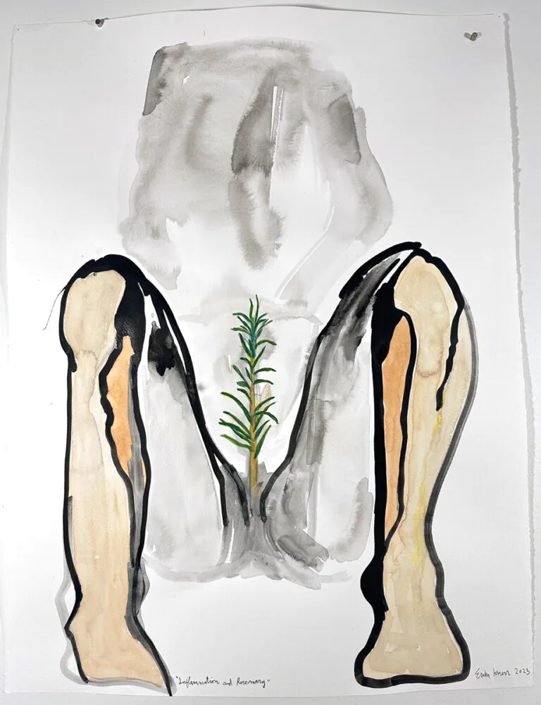 Inflammation and Rosemary